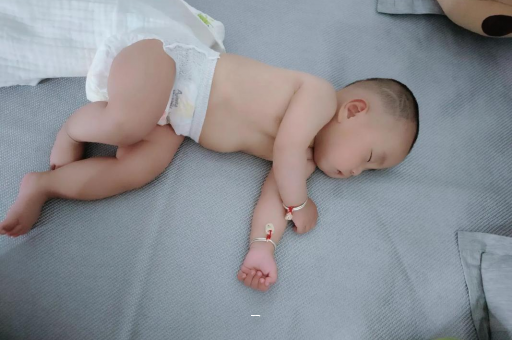 博白宝宝脸上有白色斑块